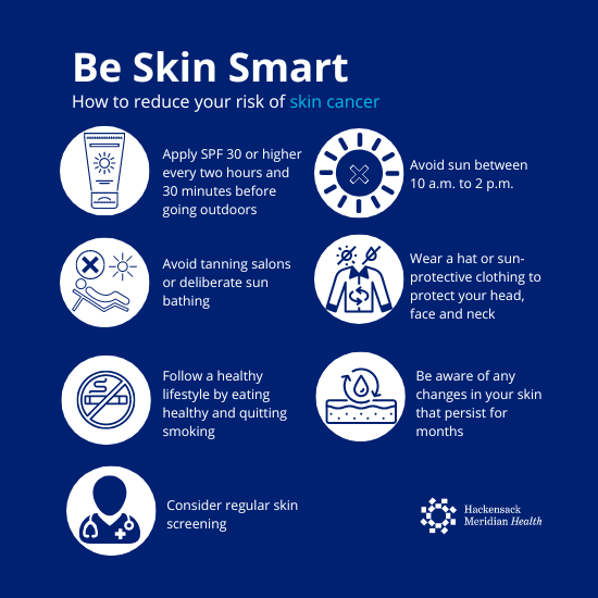 Be Skin Smart Infographic